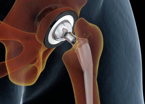 How Reputed Orthopedic Services Help in Hip Recovery