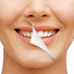 How Be Well Dental Customizes Care for Each Unique Smile