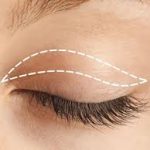 Discover a New Look: Why Blepharoplasty in Dubai Is Gaining Global Attention